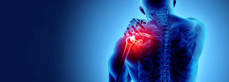 Shoulder pain